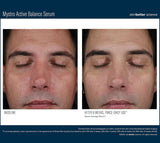 Mystro Active Balance Serum