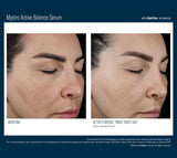 Mystro Active Balance Serum