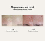 The LYMA Skincare Starter Kit | Buy Online in Australia