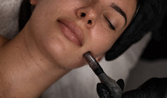 Skin Needling: Everything You Need to Know Before You Book