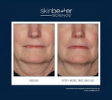 InterFuse Treatment Cream FACE + NECK