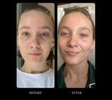 Miracle Collagen 7-Day Kit