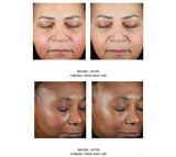 Trio Luxe Moisture Treatment